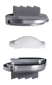 Lumbar Artificial Disc Replacement